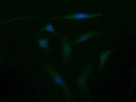 PathPlus™ CD105 Antibody (clone 8A1)