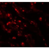 CEACAM5 / CD66e Antibody