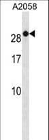 RAB7B Antibody (aa168-197)