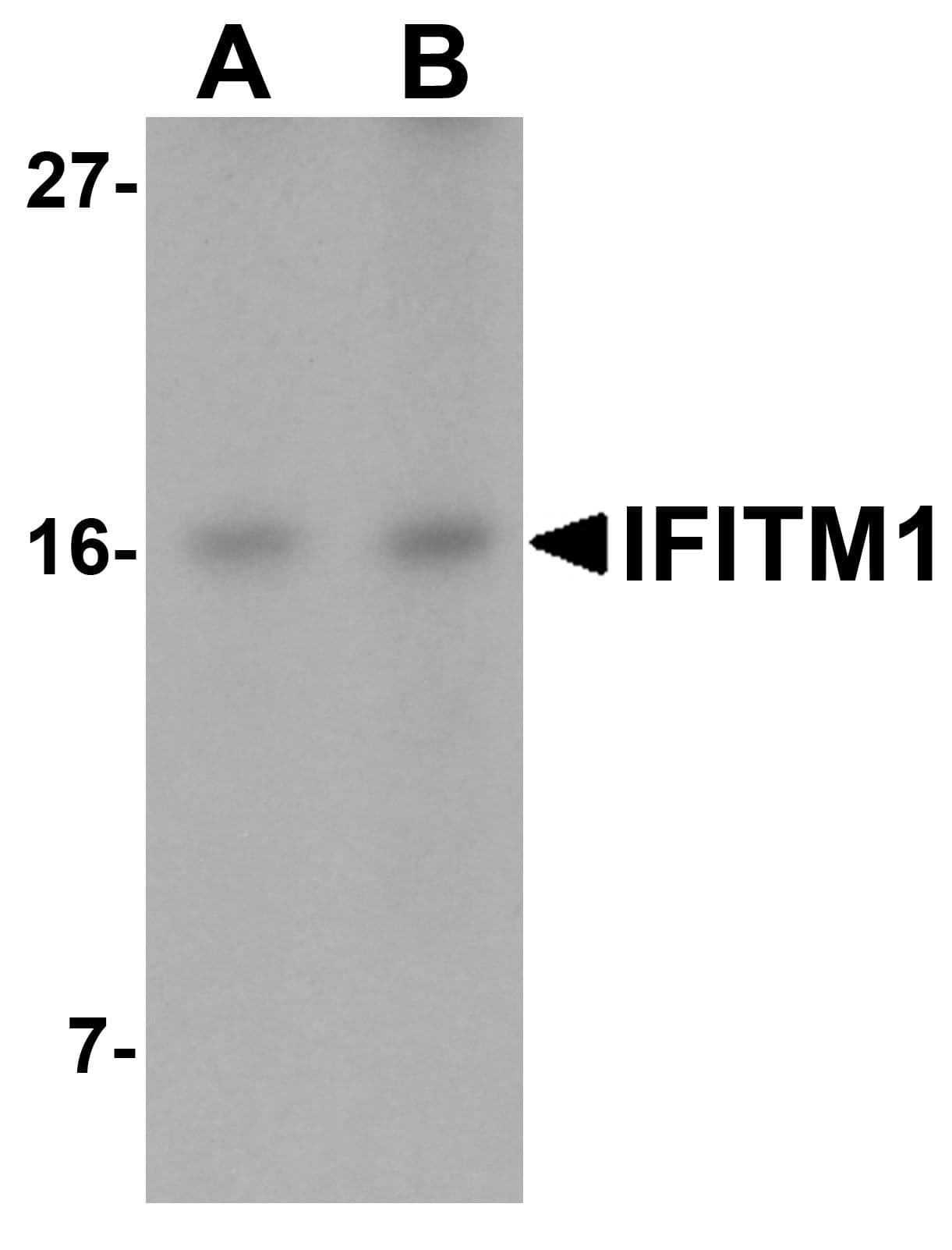 IHC-plus™ CD225 / IFITM1 Antibody