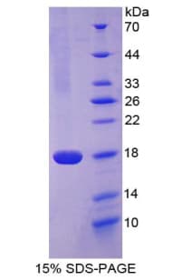 Rat CD99 Protein (Recombinant His-T7)