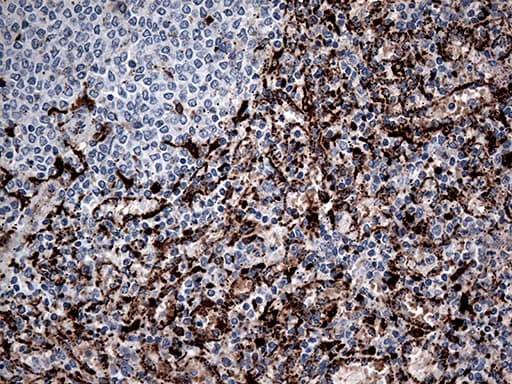 CTSL / Cathepsin L Antibody (aa114-333, clone OTI5A5)