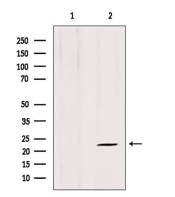 ARL8B Antibody