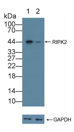 RICK / RIP2 Antibody (aa432-540)