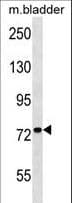 ADCK3 / CABC1 Antibody (aa396-423)