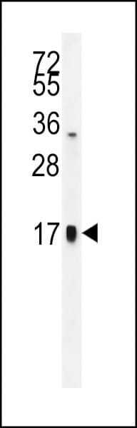 CGA / hCG Alpha Antibody (aa74-103)