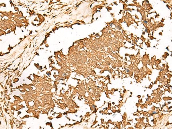 Polyclonal Rabbit anti-Human IEF-SSP-9502 / PWP1 Antibody (IHC)
