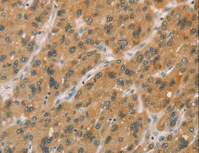 Polyclonal Rabbit anti-Human P450SCC / CYP11A1 Antibody (IHC)