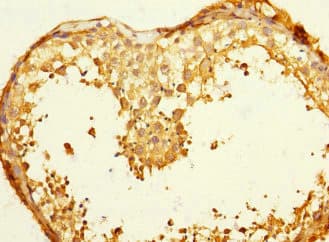 Polyclonal Rabbit anti-Human FGF12 Antibody (IHC)
