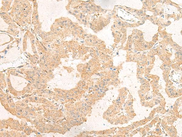 GNAT3 / Gustducin Antibody