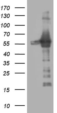 RING1 Antibody (aa88-362, clone OTI3G7)