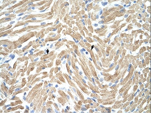 TPM1 / Tropomyosin Antibody (aa20-69)