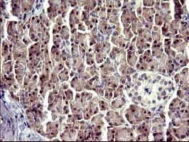 ATXN7L1 Antibody (clone OTI4F6)