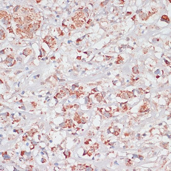 DSP / Desmoplakin Antibody