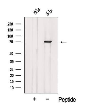 Polyclonal Rabbit anti-Human KATNB1 Antibody (WB)