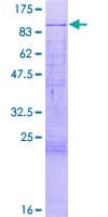 Human MTA2 Protein (Recombinant GST)