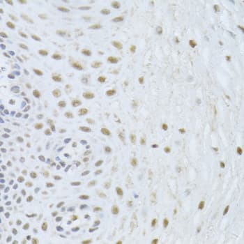 BAG1 / BAG-1 Antibody