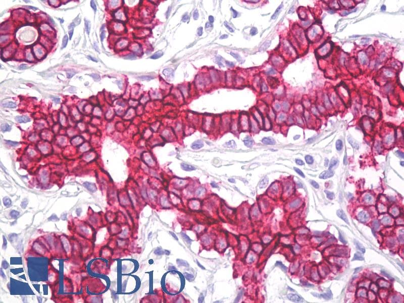 IHC-plus™ KRT8 / CK8 / Cytokeratin 8 Antibody (aa434-483)