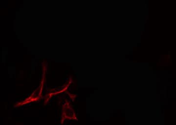 SIP / TP53INP1 Antibody