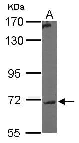Polyclonal Rabbit anti-Human GALNT7 Antibody (aa24-515, IHC, WB)