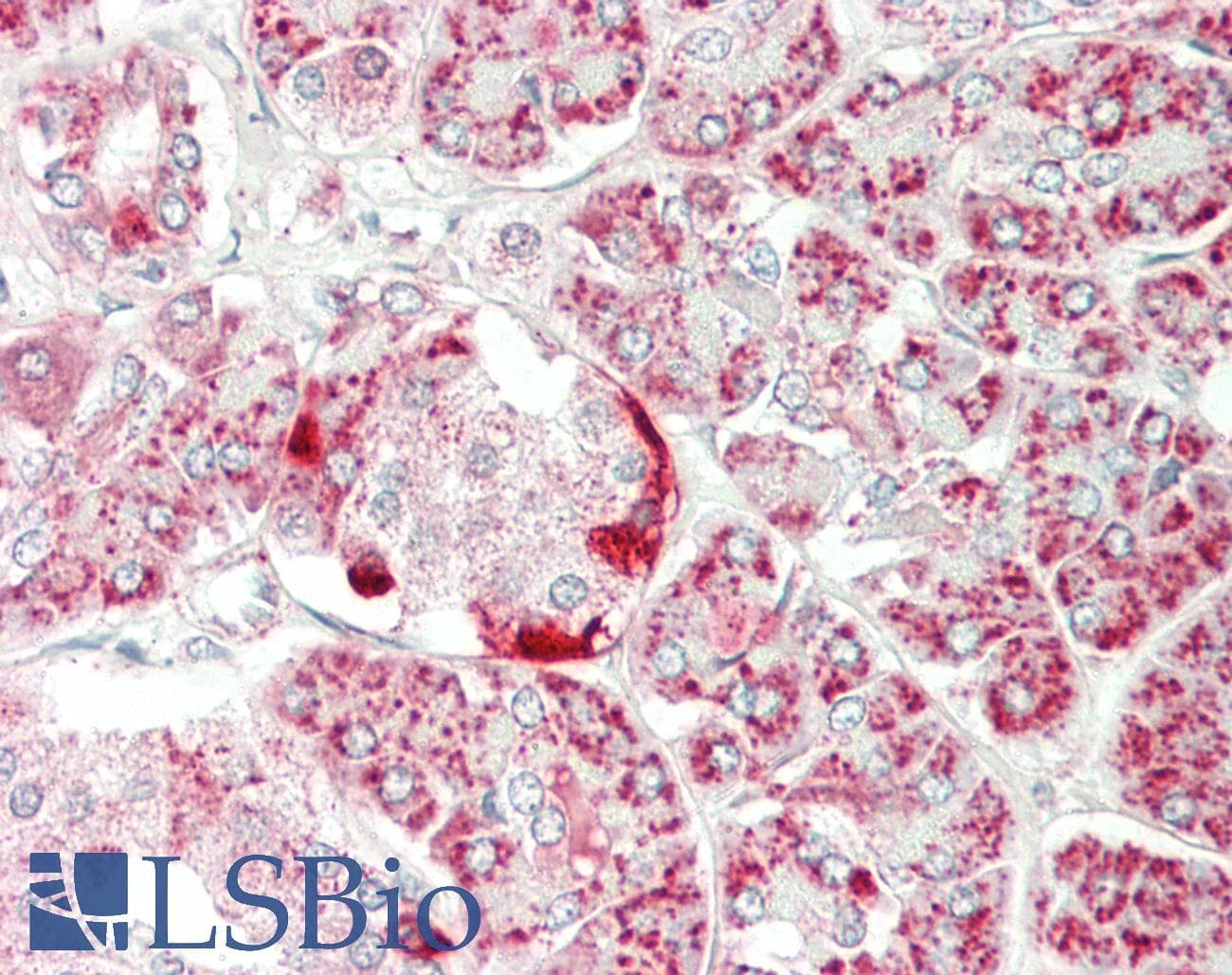 IHC-plus™ CLPP Antibody (aa215-277)