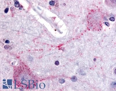 IHC-plus™ PACE4 / PCSK6 Antibody (Internal)