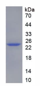 Rat NME6 Protein (Recombinant His-T7)