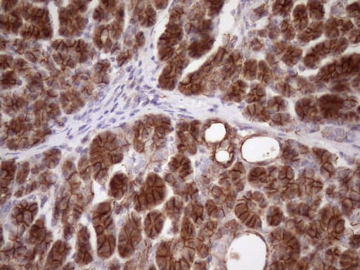 CTNNB1 / Beta Catenin Antibody (aa29-118, clone OTI2F10)