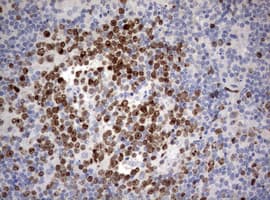 MKI67 / Ki67 Antibody (aa1160-1493, clone OTI16E9)