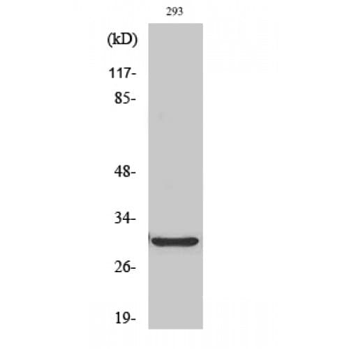 ABCC13 Antibody (30-110 aa, Internal)