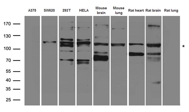 EPHA3 / EPH Receptor A3 Antibody