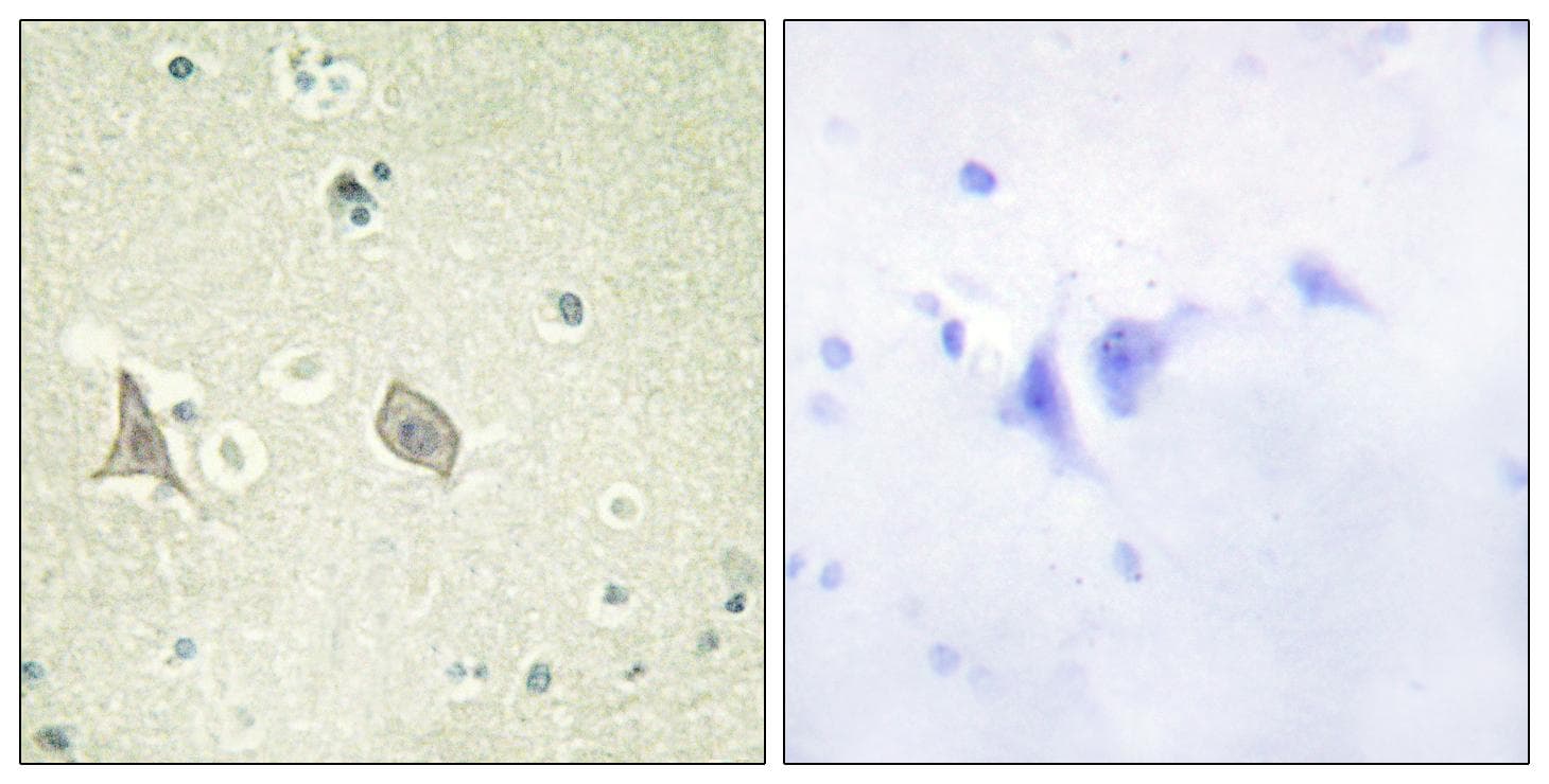 CSF1R / CD115 / FMS Antibody (phospho-Tyr723)