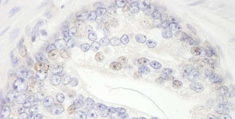 Polyclonal Rabbit anti-Human BRD3 Antibody (aa676-726, IHC, WB)
