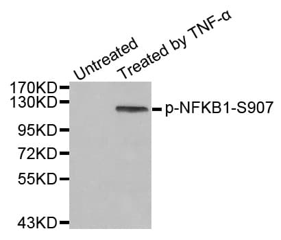 NFKB1 / NF-Kappa-B Antibody (phospho-Ser907)
