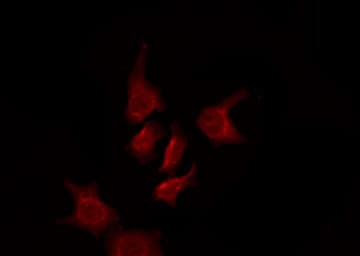 Polyclonal Rabbit anti-Human OR5AK3P Antibody (IF, WB)
