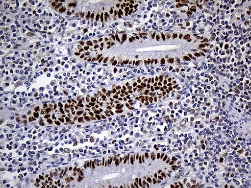 RB1 / Retinoblastoma / RB Antibody (aa309-590, clone OTI13A6)