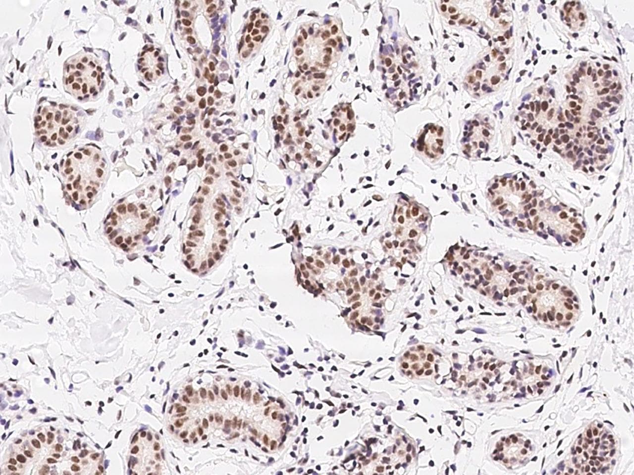 Polyclonal Rabbit anti-Human ZNF146 Antibody (IHC)