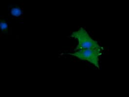 CTAG1B / NY-ESO-1 Antibody (clone OTI9H6, Carrier-free)
