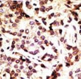 BECN1 / Beclin-1 Antibody (aa181-210)