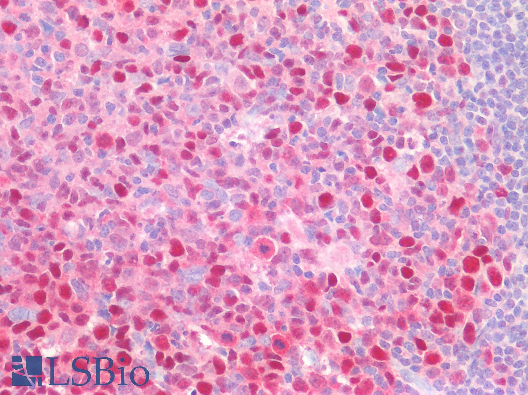 PathPlus™ PCNA Antibody