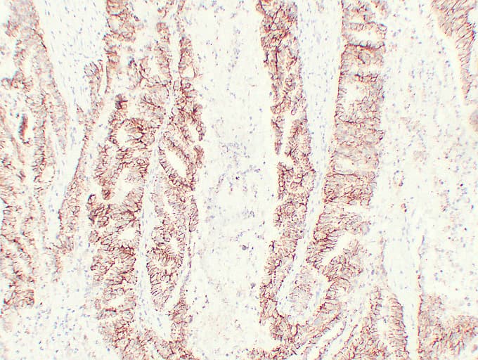 CLDN7 / Claudin 7 Antibody (clone ABT-CLD7)