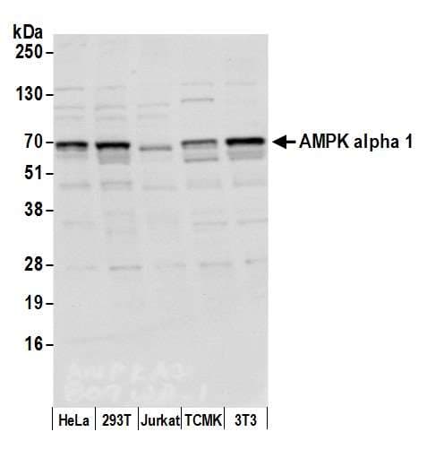 IHC-plus™ Polyclonal Rabbit anti-Human PRKAA1 / AMPK Alpha 1 Antibody (aa350-400, IHC, WB)