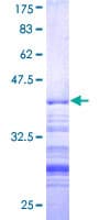 Human TRIP12 Protein (Recombinant GST, N-terminus)