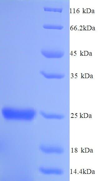 Mouse GSTP1 / GST Pi Protein (Recombinant His)
