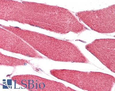 IHC-plus™ Polyclonal Goat anti-Human CHCHD3 Antibody (aa173-185, IHC, WB)