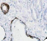Keratin, HMW Antibody (clone 34BE12)