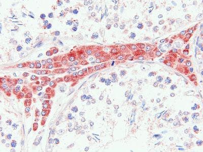 A2M / Alpha-2-Macroglobulin Antibody (clone PSA24)
