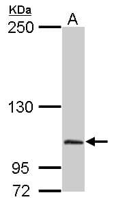 IHC-plus™ Dipeptidylpeptidase 8 / DPP8 Antibody (aa349-662)