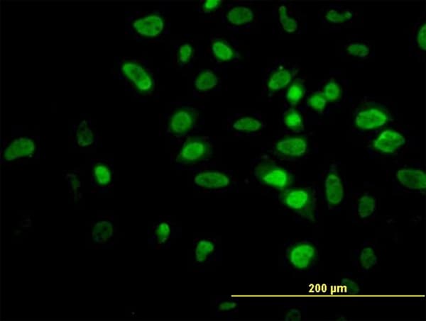 AKT2 Antibody (clone X1)