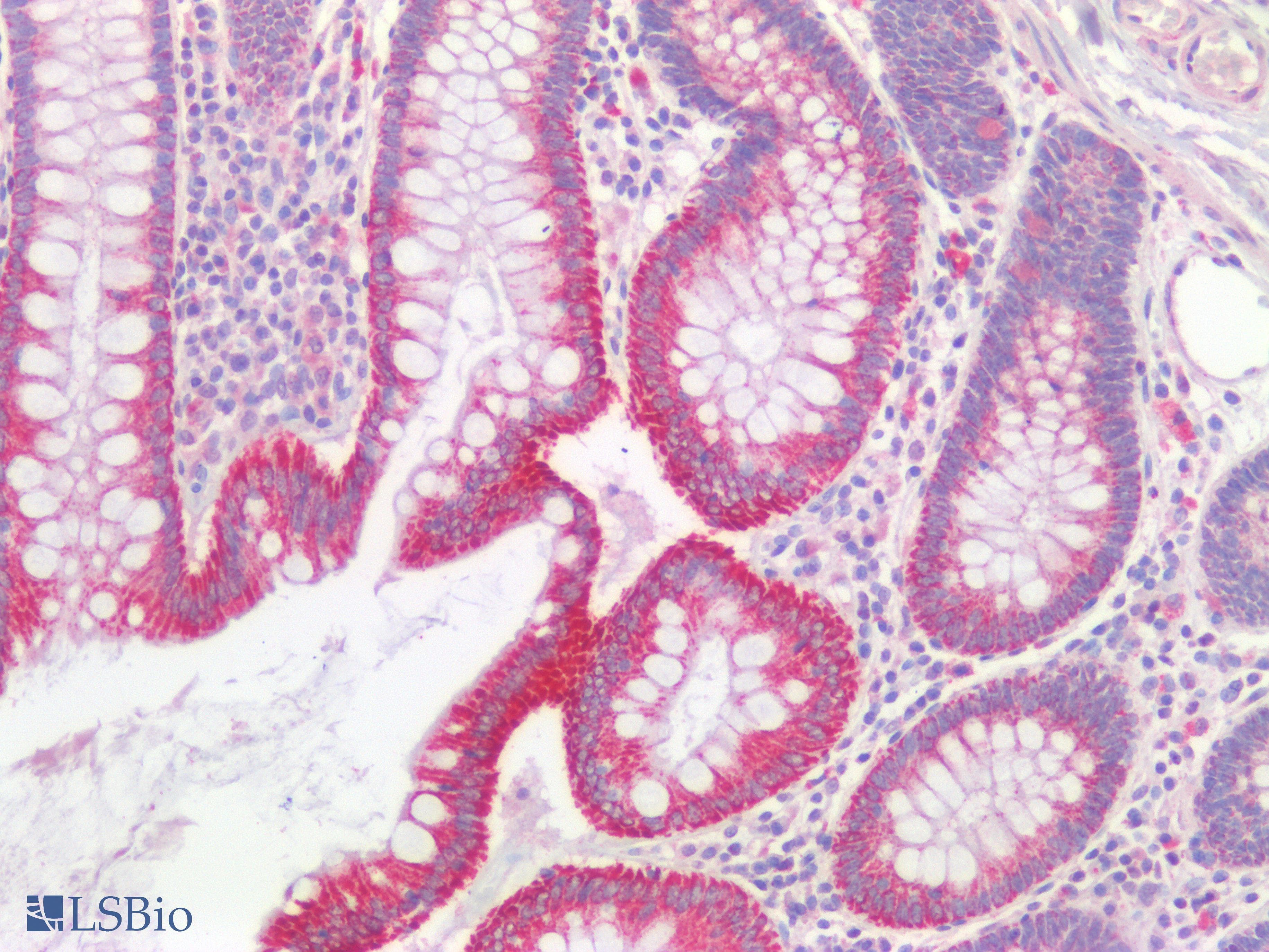 PathPlus™ Polyclonal Rabbit anti-Human TJP1 / ZO-1 Antibody (IHC)